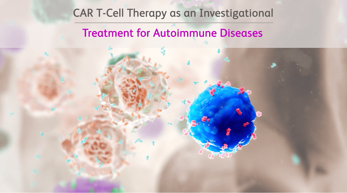 Video preview showing CAR T-cell therapy as an investigational treatment for autoimmune diseases.